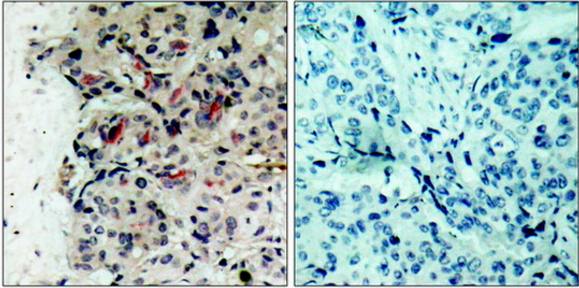 JAK1 (Ab-1022) Antibody