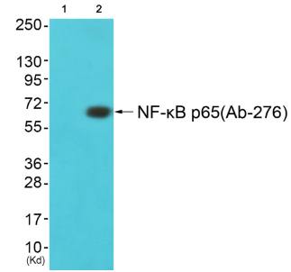 NF-κB p65 (Ab-276) Antibody