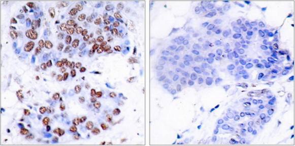 NF-κB p65 (Ab-276) Antibody