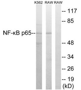 NF-κB p65 (Ab-276) Antibody