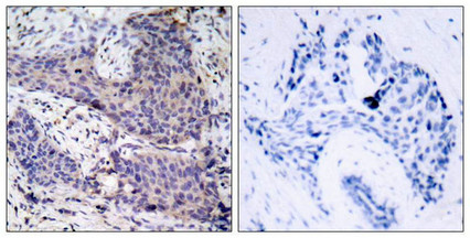 Bad Antibody