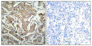 Bad Antibody