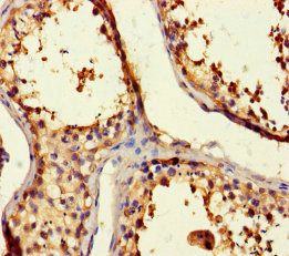 BAG5 Antibody