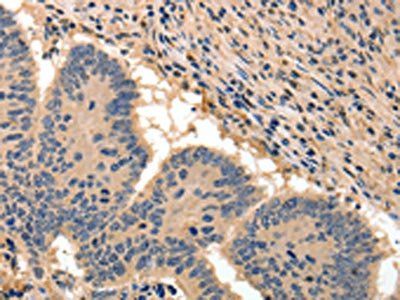 BAIAP2 Antibody
