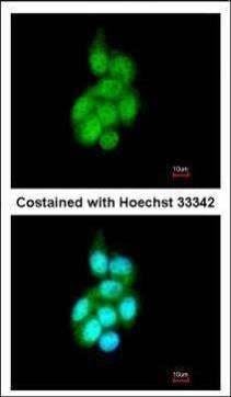 BAIAP2L1 Rabbit Polyclonal Antibody