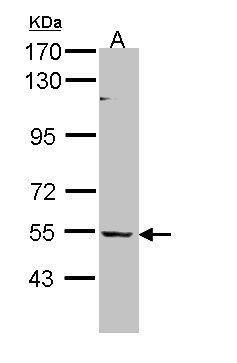 BAIAP2L1 Rabbit Polyclonal Antibody