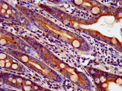 BAIAP3 Antibody