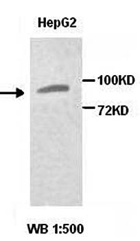 BAL Rabbit Polyclonal Antibody