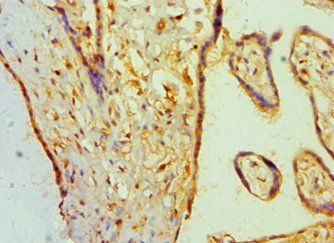 BAMBI Antibody