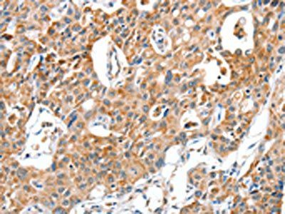 BAX Antibody