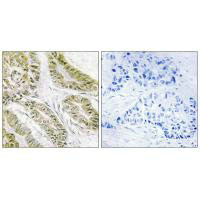 BAX Antibody