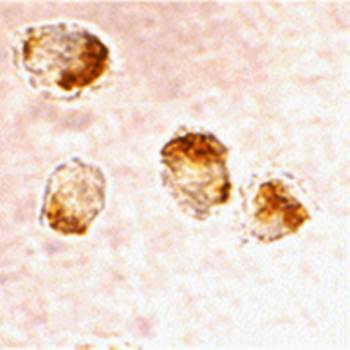 Bax Antibody
