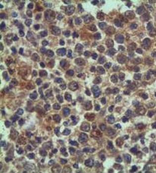 BAX Rabbit Polyclonal Antibody