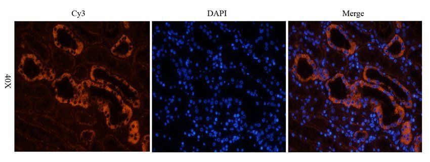 BAZ2A antibody