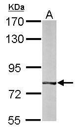 BBS7 Rabbit Polyclonal Antibody