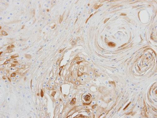BCAT2 Rabbit Polyclonal Antibody
