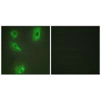 BCKDK Antibody