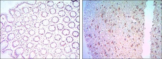 BCL-2 Antibody