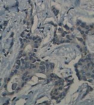 BCL10 Rabbit Polyclonal Antibody