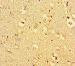 BCL11B Antibody