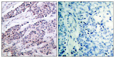 BCL2 Antibody