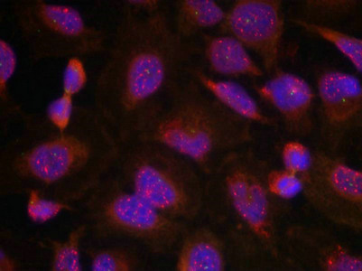 BCL2 Antibody