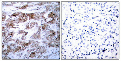 BCL2 Antibody