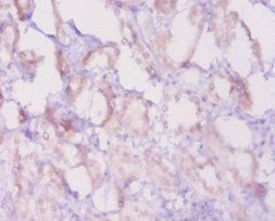 Bcl2 Antibody