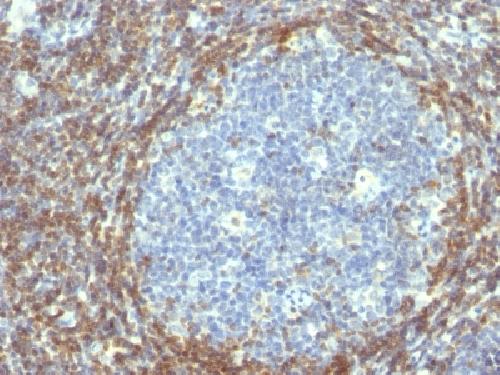 Bcl-2 (Apoptosis & Follicular Lymphoma Marker) Antibody