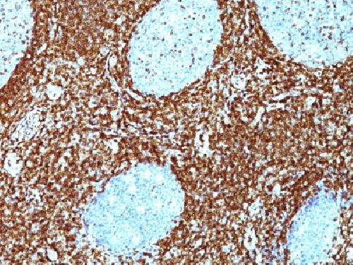 Bcl-2 (Apoptosis & Follicular Lymphoma Marker) Antibody
