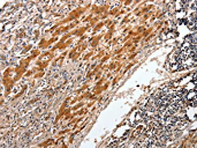 BCL2 Antibody