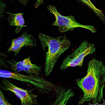 BCL-2 (Ab-56) Antibody