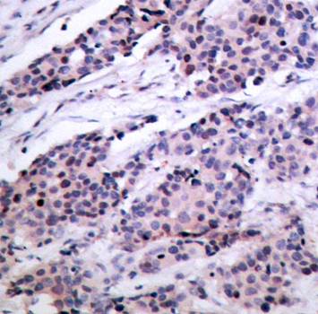 BCL-2 (Ab-56) Antibody