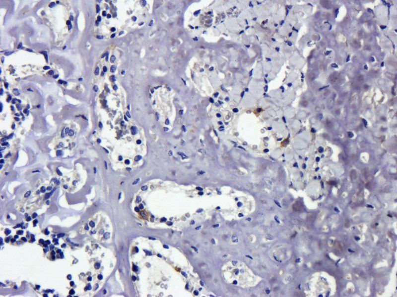 BCL2 antibody