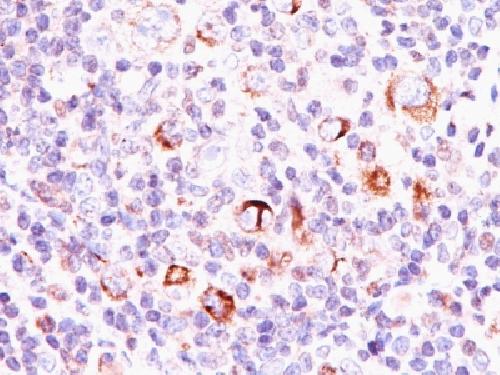 BCL2L1 Antibody