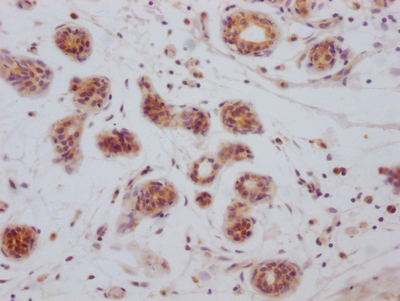 BCL2L1 Recombinant Monoclonal Antibody
