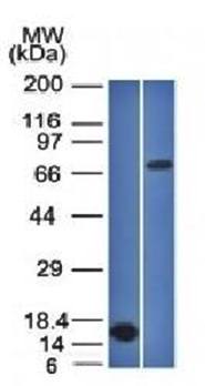 BCL6 Antibody