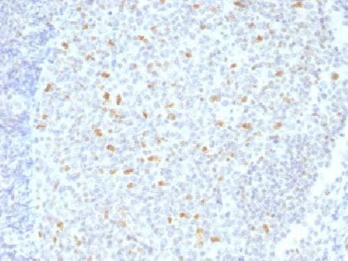 BCL6 Antibody