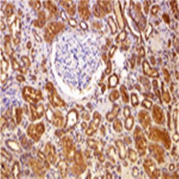 Bcl-2 Antibody