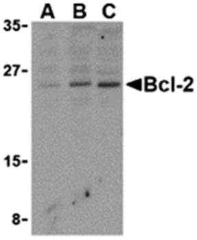 Bcl-2 Antibody