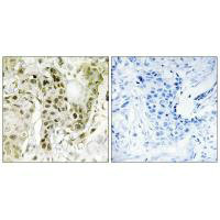 BCOR Antibody