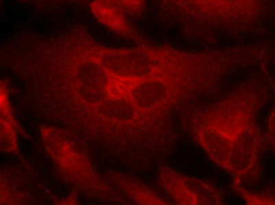BCR Antibody