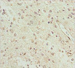 BCS1L Antibody