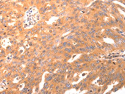 BDKRB2 Antibody