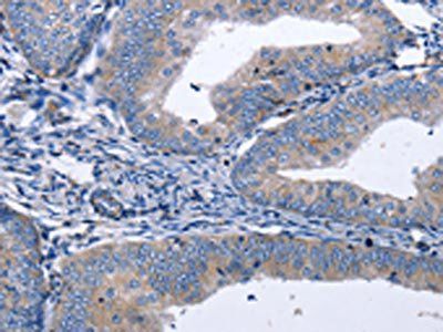 BDNF Antibody