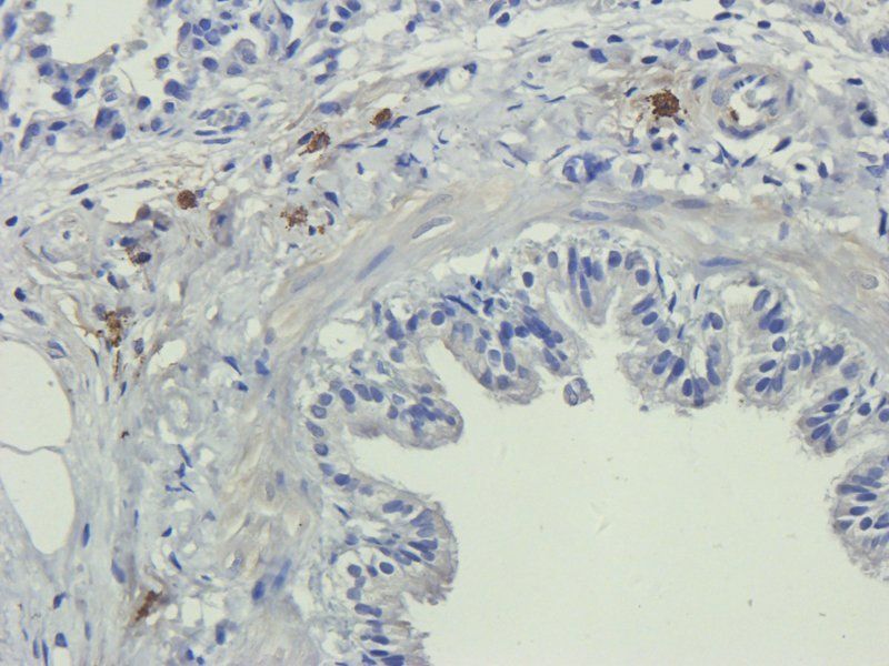 BDNF Rabbit Polyclonal Antibody