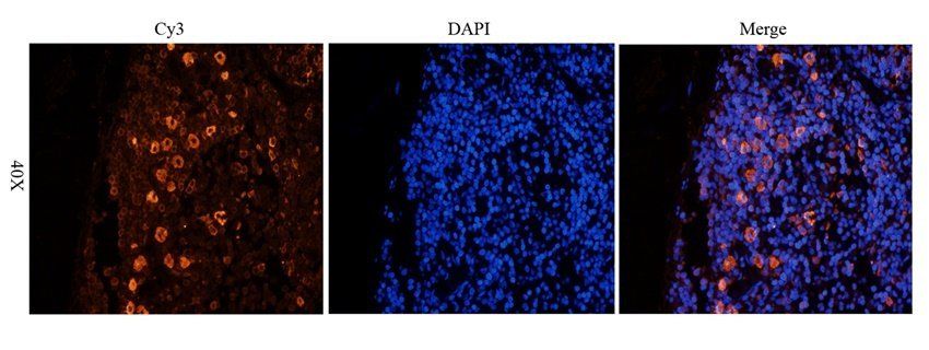 Beclin 1 antibody