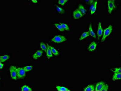 ADRB1 Antibody