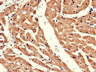 ADRB1 Antibody