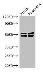 ADRB1 Antibody